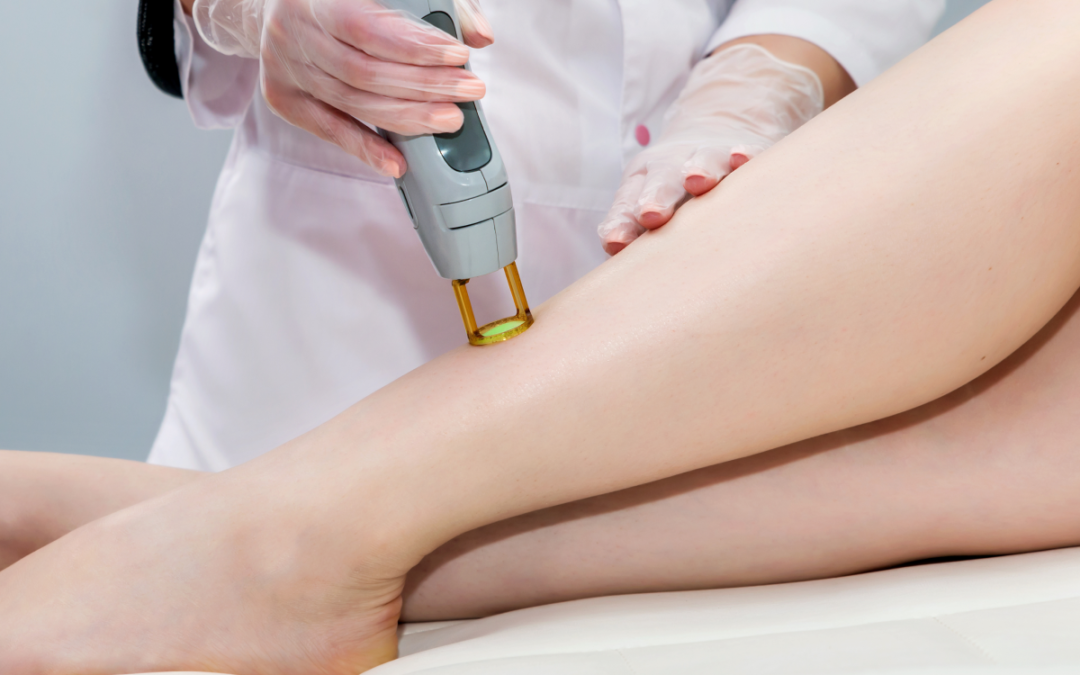 Laser Hair Removal: Is It Better Than Waxing and Epilation?