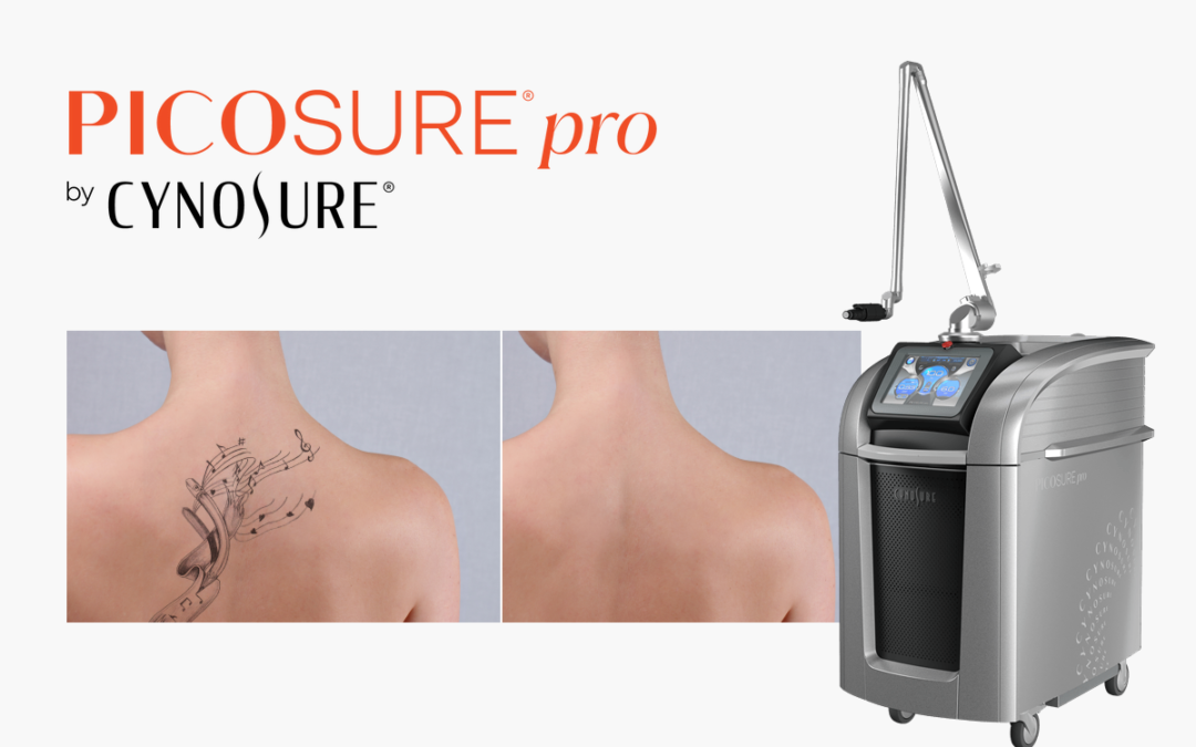 How To Remove a Tattoo with PicoSure Pro