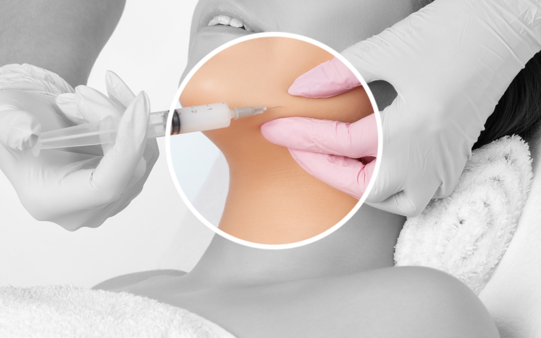 Eliminate Your Double Chin without Surgery: Non-Invasive Treatments that Remove Submental Fat