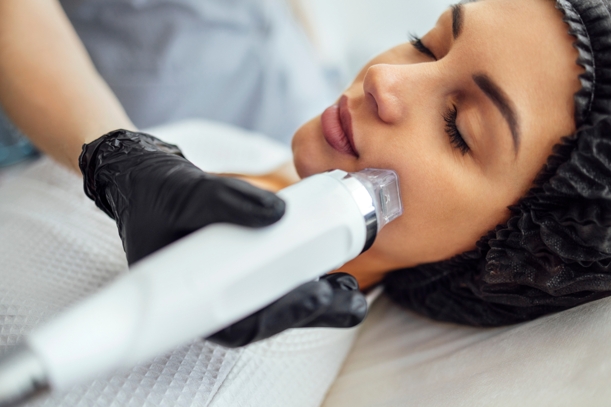 Microneedling for Premature Aging